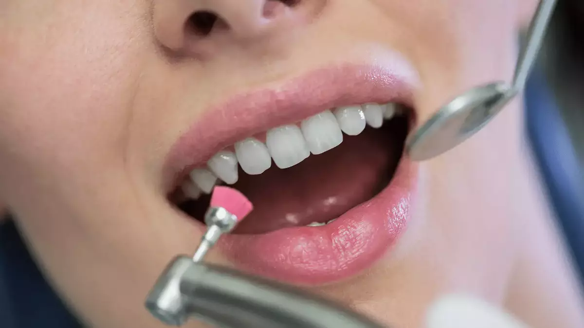 Instrumentos para Ortodoncia y Odontología